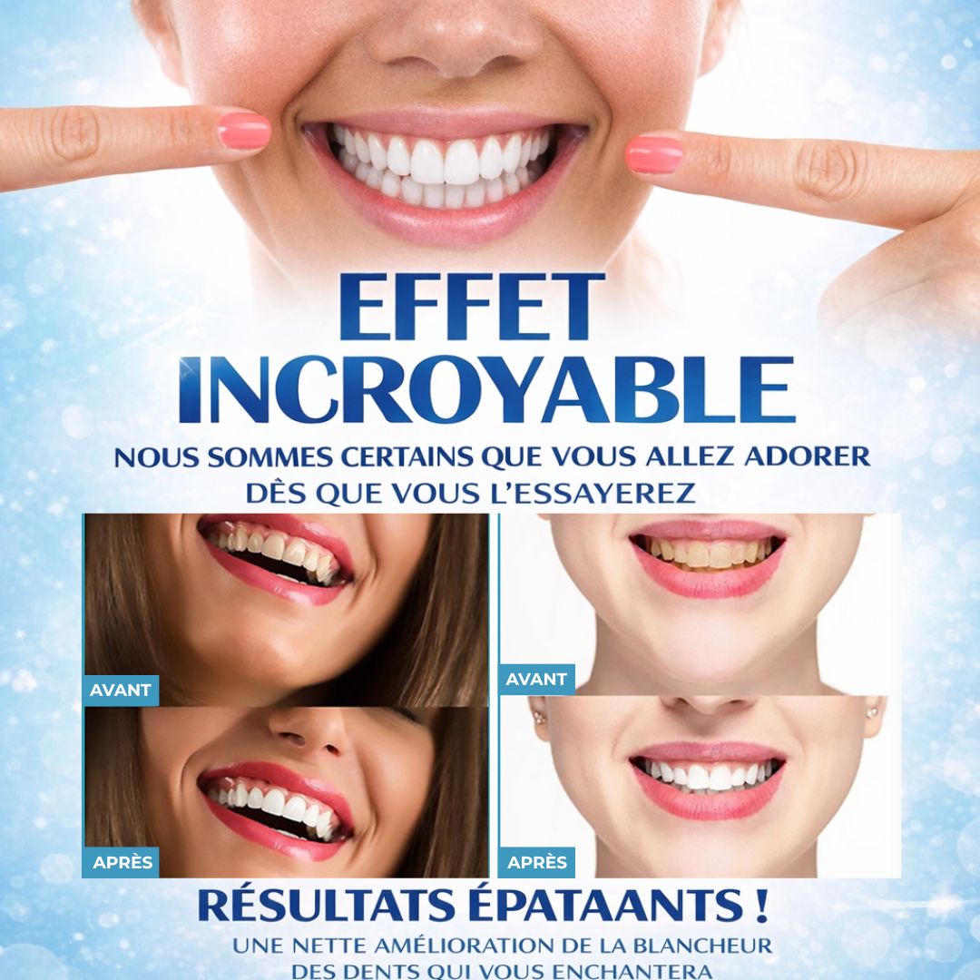 Polissage dentaire - Dents blanches instantanées