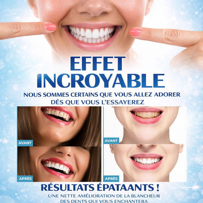Polissage dentaire - Dents blanches instantanées